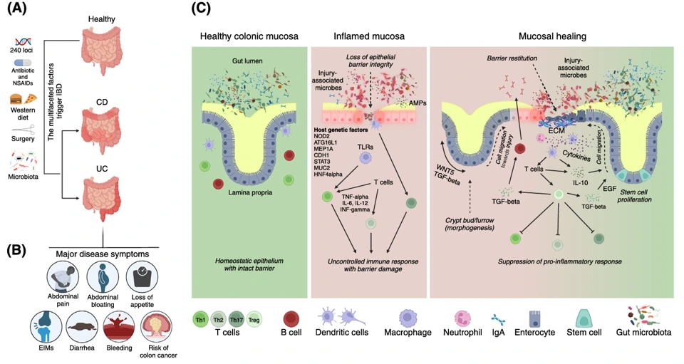 Preview of Revolutionizing IBD research with on-chip models of disease modeling and drug screening