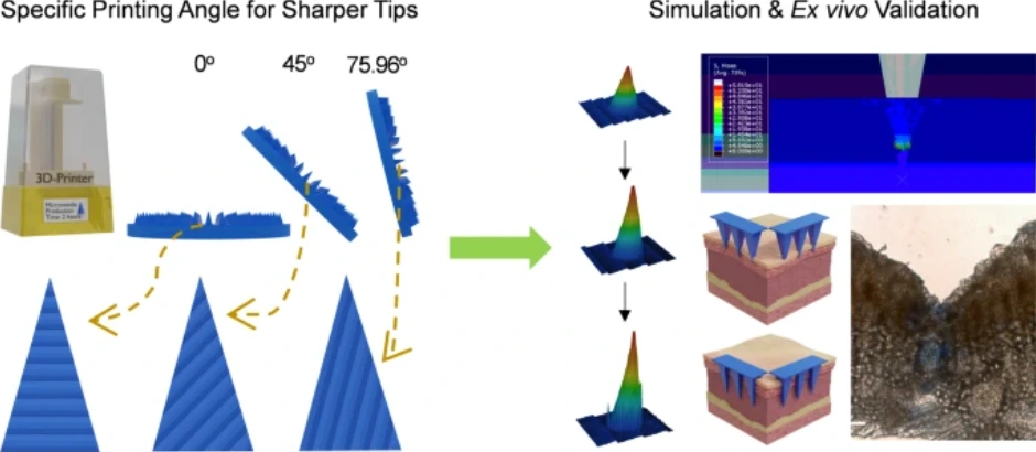 Preview of An Aspect Ratio–Guided Printing Angle Optimization Framework for 3D-Printed Microneedles