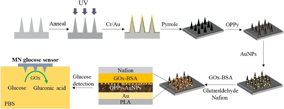 Preview of Recent Advances in Microneedle-Based Sensors for Sampling, Diagnosis and Monitoring of Chronic Diseases