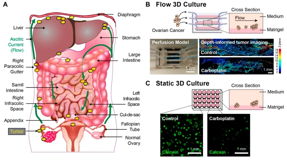 Preview of Flow-induced Shear Stress Confers Resistance to Carboplatin in an Adherent Three-Dimensional Model for Ovarian Cancer: A Role for EGFR-Targeted Photoimmunotherapy Informed by Physical Stress
