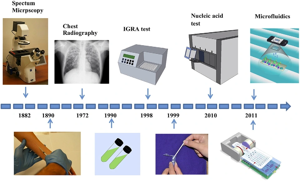 Preview of Point-of-care Assays for Tuberculosis: Role of Nanotechnology/Microfluidics